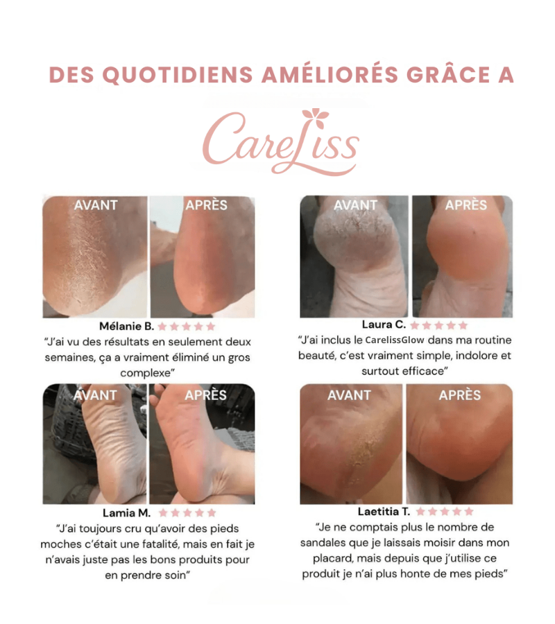 ✨ Careliss Glow - Kit de Beauté Pieds